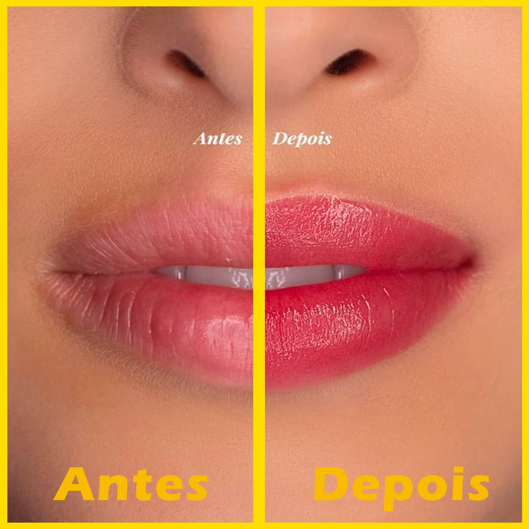 modelo-antes-depois2